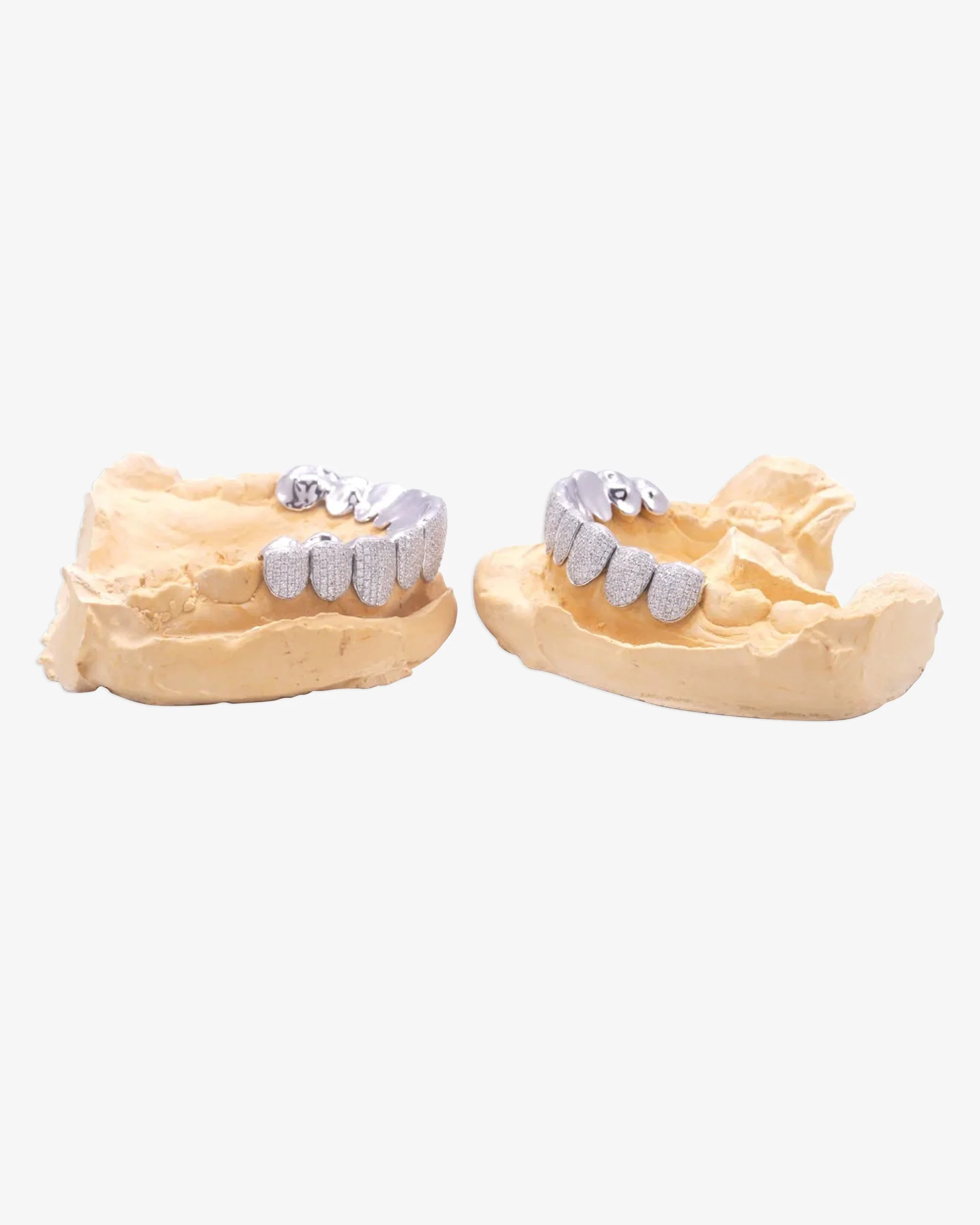 10 on 10 VVS Moissanite Prong Diamond Grillz - Image 4