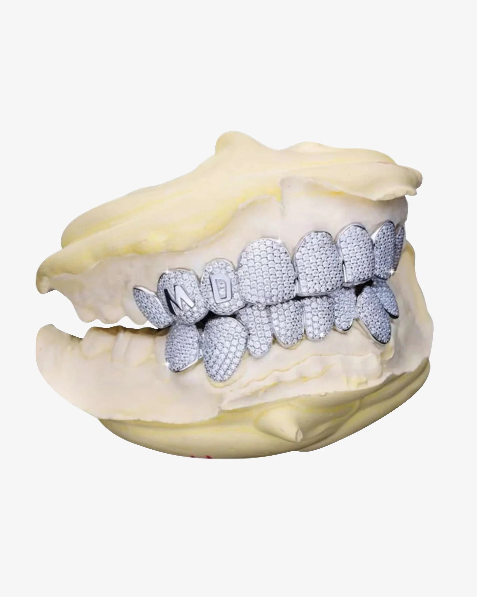 Custom Letter Moissanite Grillz - Image 3