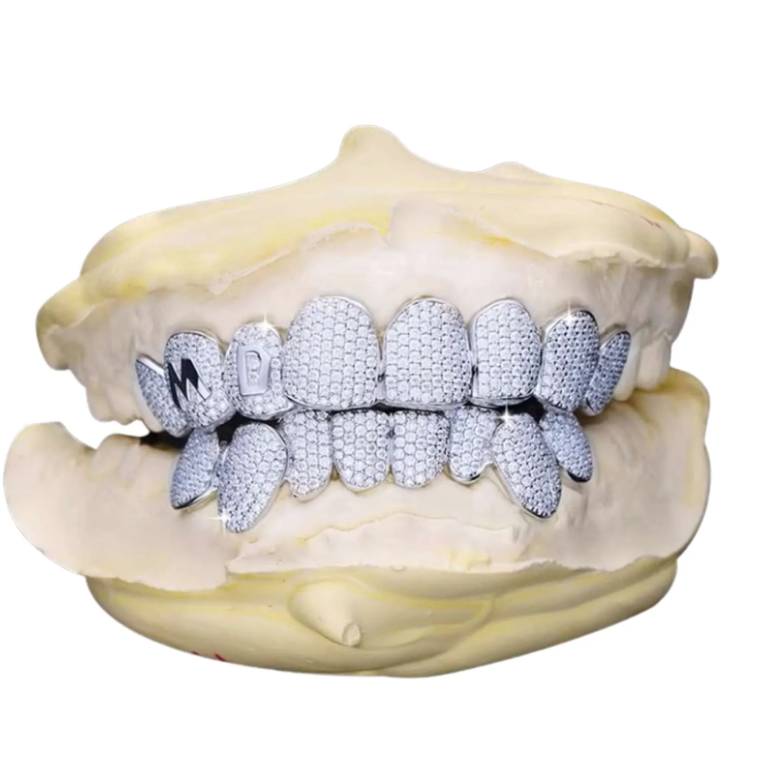 Custom Letter Moissanite Grillz - Image 4
