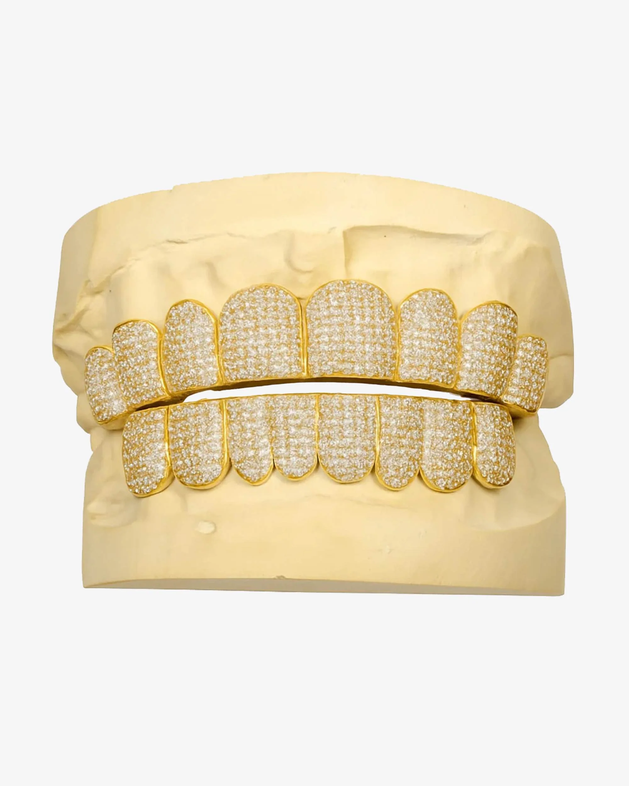 Custom Moissanite Diamond Grillz 14K Yellow Gold