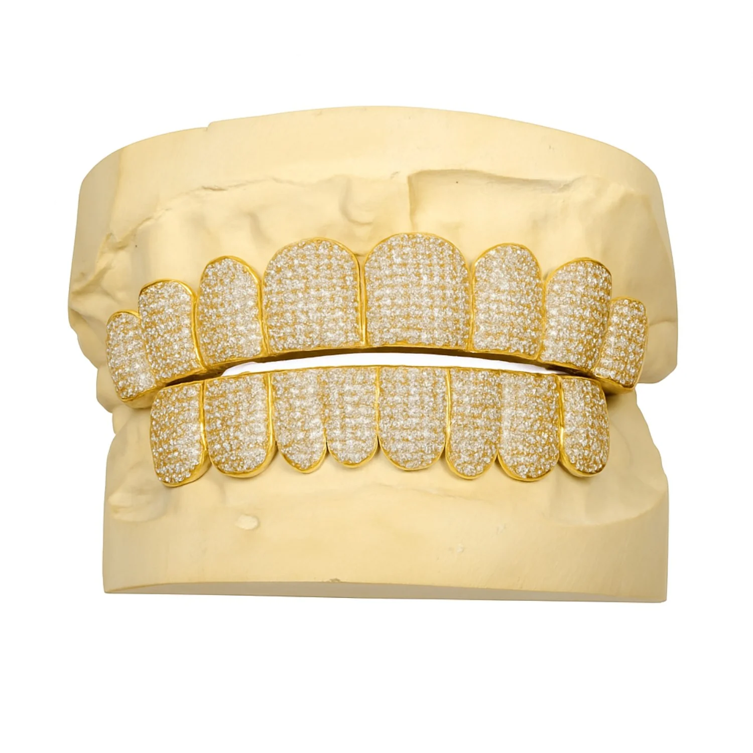 Custom Moissanite Diamond Grillz 14K Yellow Gold - Image 3