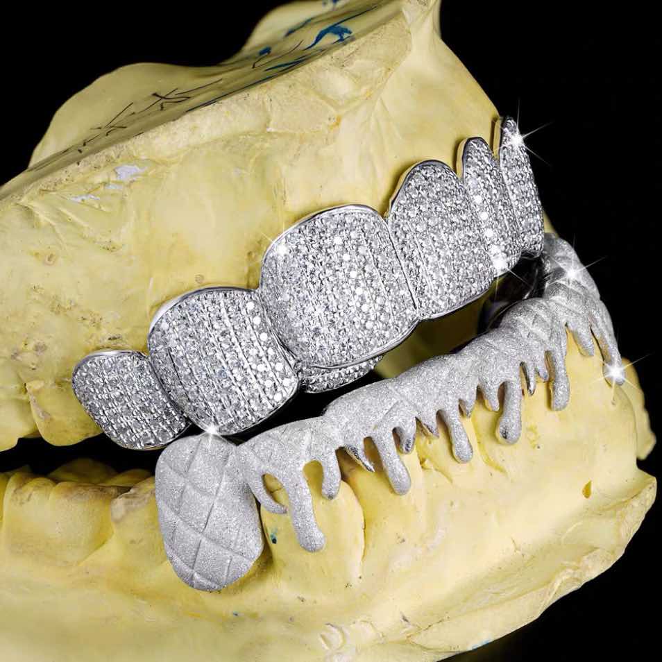 Moissanite Drippy Grillz 14K Gold - Image 3