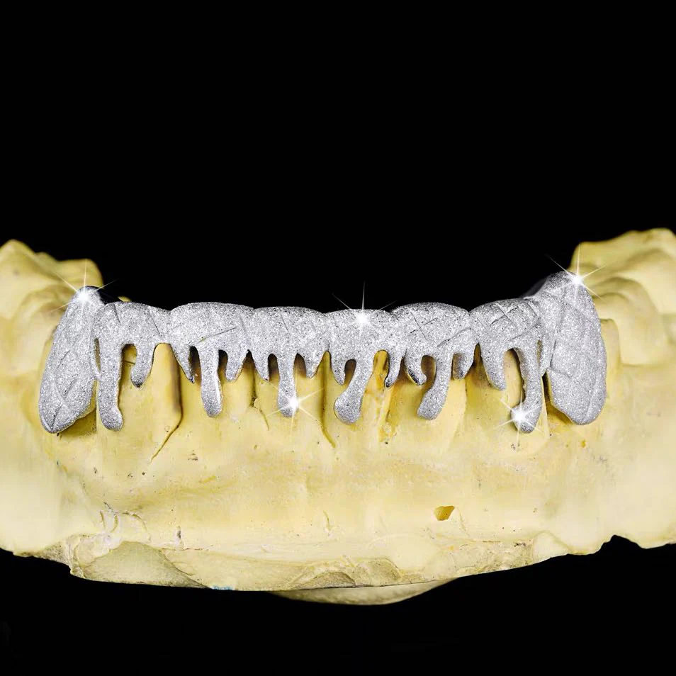 Moissanite Drippy Grillz 14K Gold - Image 4