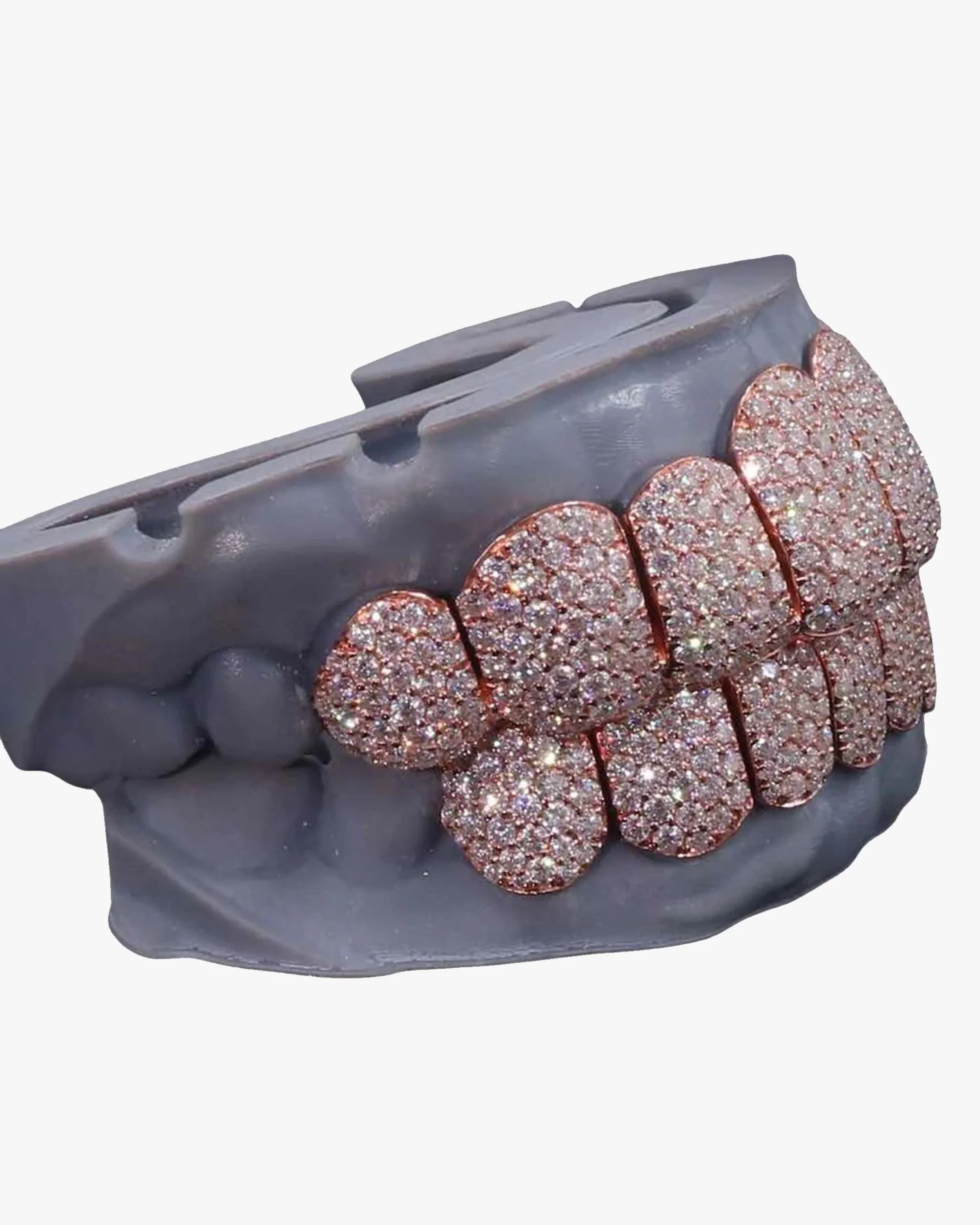 Rose Gold Perm Cut Custom Diamond Grillz 14K Gold - Image 2