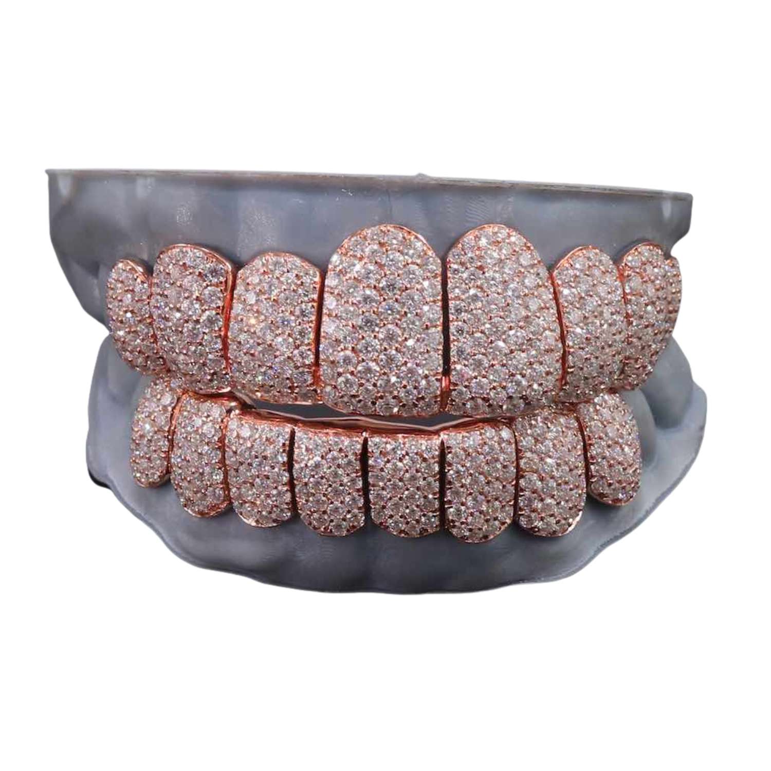 Rose Gold Perm Cut Custom Diamond Grillz 14K Gold - Image 3